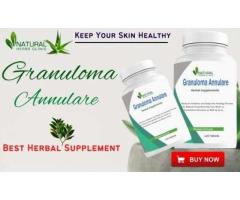 Herbal Supplement for Granuloma Annular